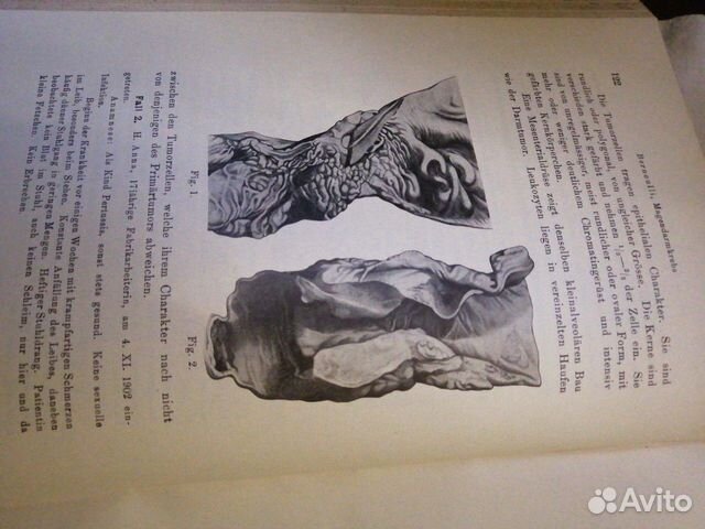 Книга по Медицине, Старинная Книга по Медицине, Старинная