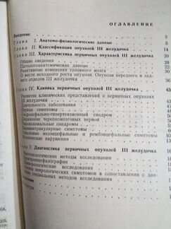 Опухоли третьего желудочка мозга